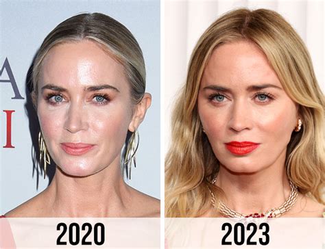 Fans Speculate That Emily Blunt Had Plastic Surgery After Her Latest
