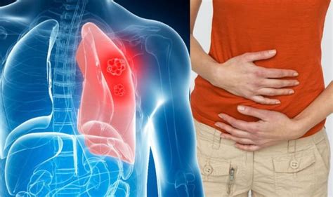 Lung Cancer Symptoms Why You Should Never Ignore Feeling Queasy
