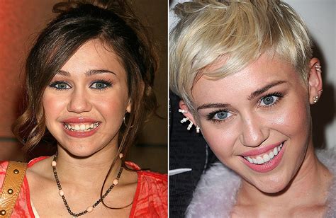 Celebrity Smile Transformations Mirror Online