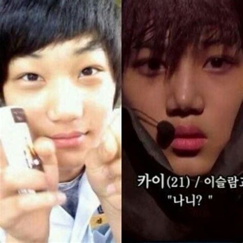 Netizens Claim Exo S Kai Is Suffering Side Effects From Plastic Surgery