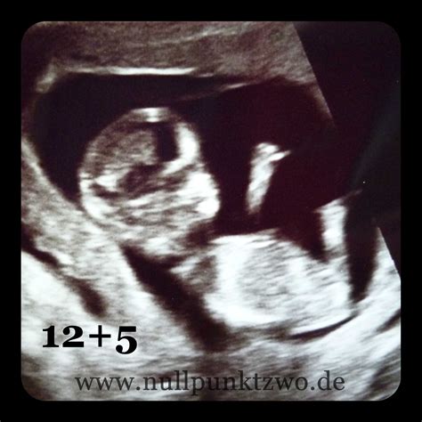 Bauchbilder Ultraschallbilder Und Schwangerschaftstests 3