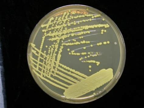 Micrococcus Luteus Microbiology Medical Laboratory Science Medical