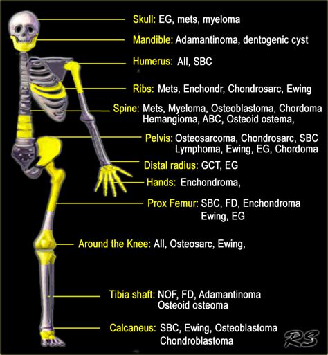 Radiologyspirit Location Within The Skeleton
