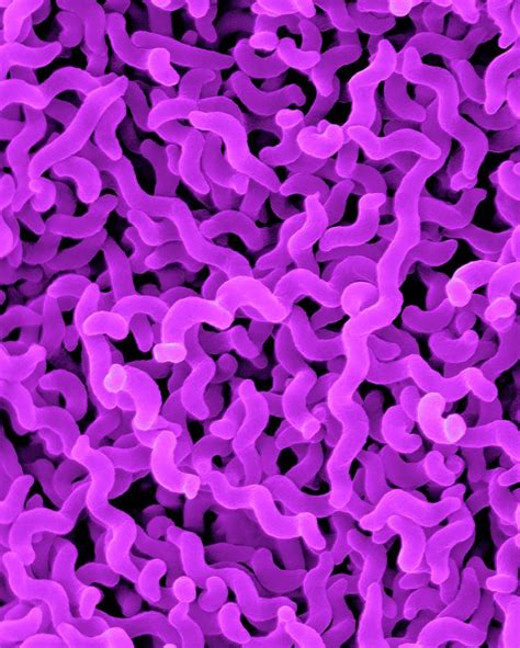 Campylobacter Jejuni Photograph By Dennis Kunkel Microscopyscience