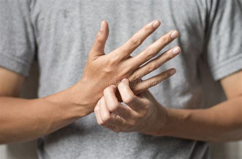 Asian Man Scratching His Hand Concept Of Itchy Skin Diseases Such As