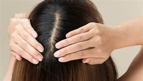 The Signs Of Thinning Hair Explained By Experts Better Not Younger