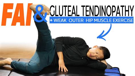 Gluteal Tendinopathy And Femoral Acetabular Impingement Hip Exercises My Xxx Hot Girl