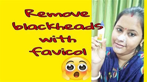 Remove Blackheads And Whiteheads With Favicol Youtube