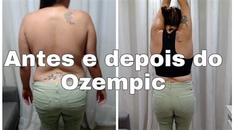 Dois Meses De Ozempic Fotos Do Meu Antes E Depois YouTube