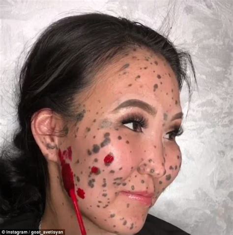 Woman Born With Moles On Face Reveals Transformation Using Make Up