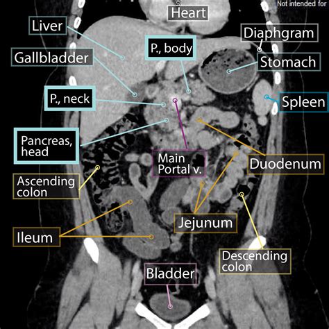 Pancreas Imaging Gross Anatomy Flashcards Ditki Medical And