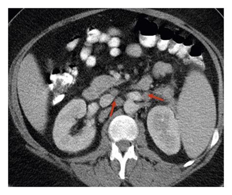 The Abdomen And Thoracic Ct Scan A Coronal Contrast Enhanced Ct