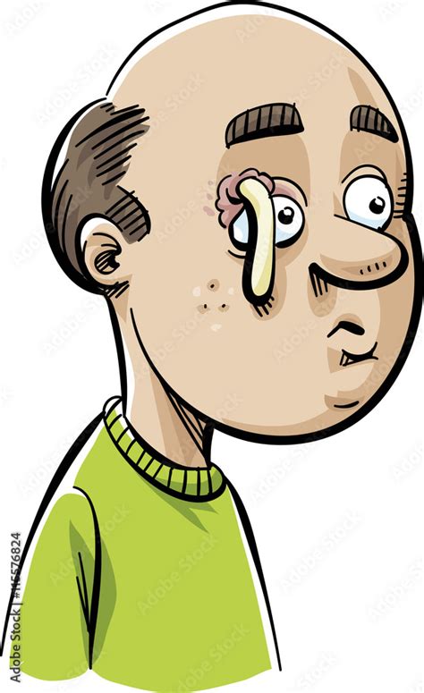 A Cartoon Man With A Stye Above His Eye That Has Popped And Is Oozing