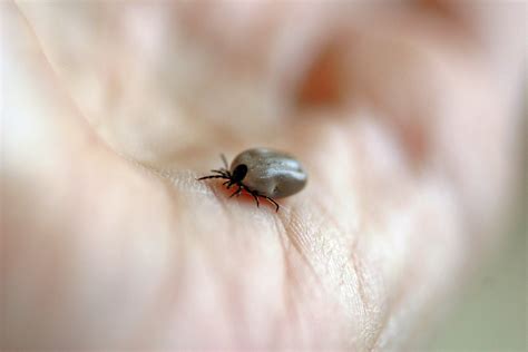 Lyme Disease A Study On The Speed Of Transmission By Infected Ticks