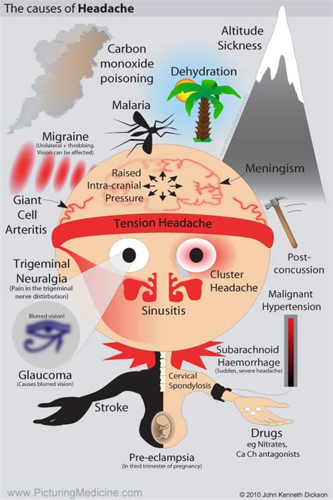Causes Of Headaches Differentials
