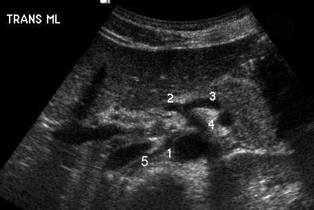 ultrasound [Nick's Radiology Wiki]