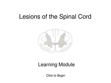 Ppt Lesions Of The Spinal Cord Powerpoint Presentation Free Download