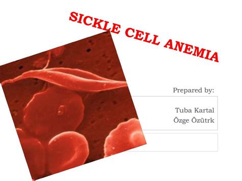 Sickle Cell Anemia Ati Template