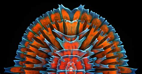 Digital Microscope Olympus Opal Phoenix