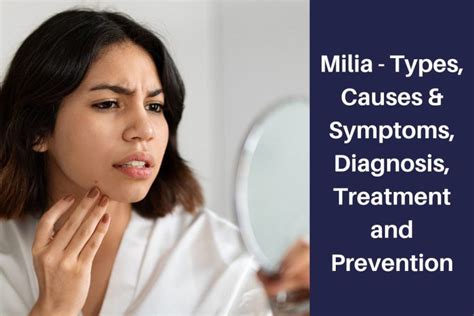 Milia Types Causes And Symptoms Diagnosis Treatment And Prevention