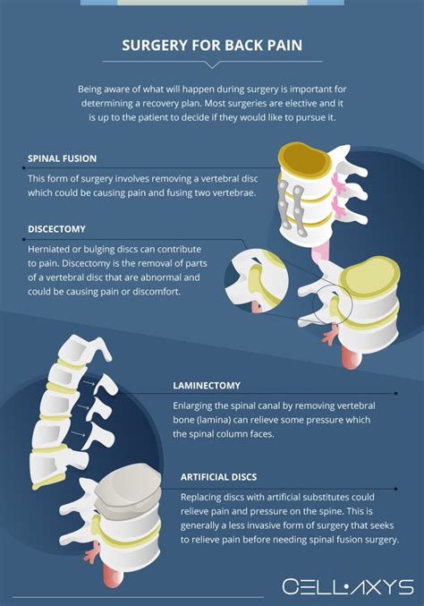 What You Need To Know About Back Pain After Surgery Cellaxys
