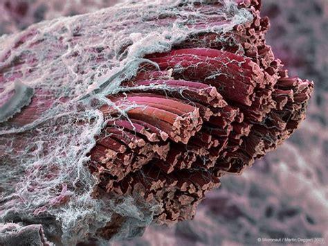 Maybe you would like to learn more about one of these? Scanning Electron Microscope Captures Muscle In the Flesh ...