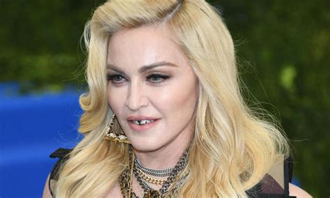 Madonna Found Unresponsive And Rushed To Hospital ‘still Under Medical Care