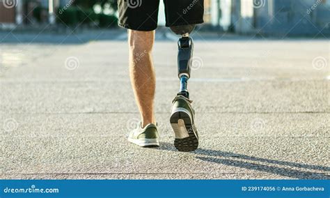 Man With Prosthetic Leg Stock Photo Image Of Lifestyle 239174056