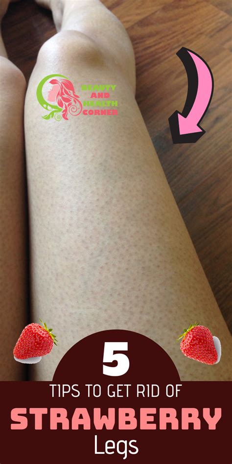 Methods And Tips To Get Rid Of Strawberry Legs Strawberry Legs Skin