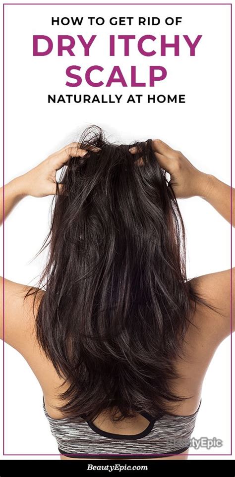 Depending on the type of fungi responsible for. 7 Simple Home Remedies For Dry Itchy Scalp in 2020 | Dry ...