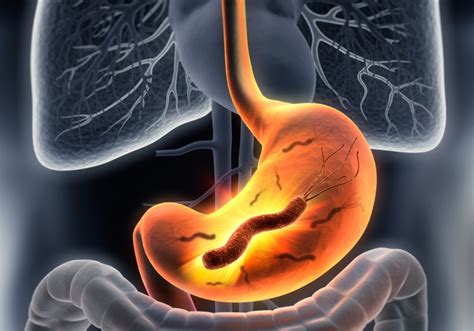 Hepatitis b existiert in europa seit mindestens 7000 jahren. Gelbe Zunge - gelber Zungenbelag - Naturheilkunde ...