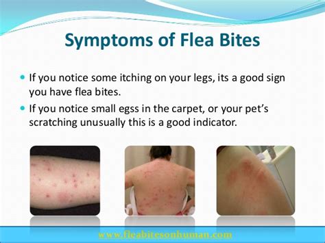 Infected Flea Bite Pictures Photos