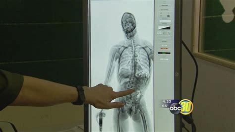 New Body Scanner Improves Safety At Merced County Jails