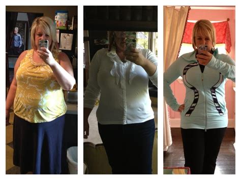 Gastric Bypass Surgery Success Stories With Before And After Photos