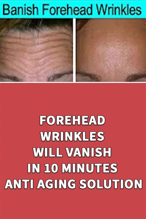 Forehead Wrinkles Will Vanish In 10 Minutes Anti Aging Solution In 2020