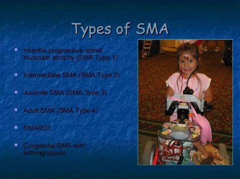 Spinal Muscular Atrophy Sma By Allelieh