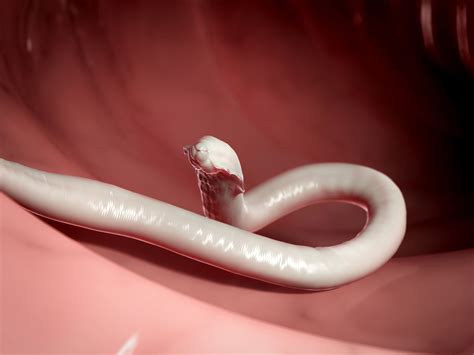 Parasite Worms In Humans