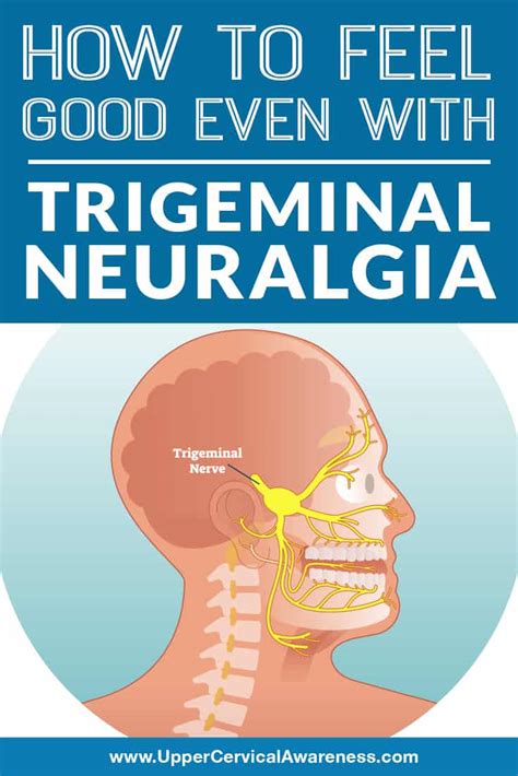 Trigeminal Neuralgia Symptoms And Conditions Upper Cervical Awareness