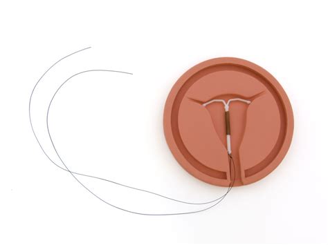 How To Check Iud Strings
