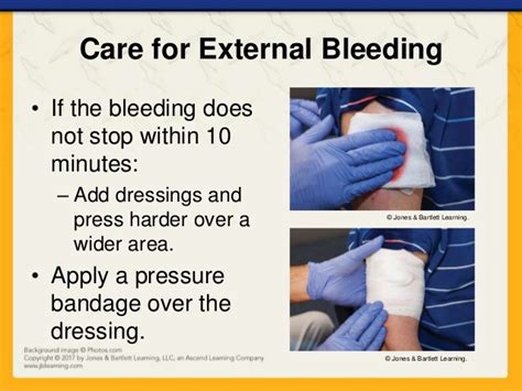 Ch08 Presentation Bleeding