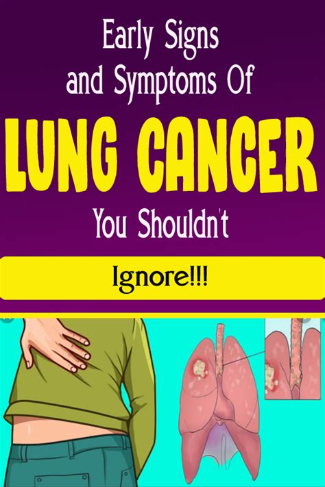 Early Signs And Symptoms Of Lung Cancer You