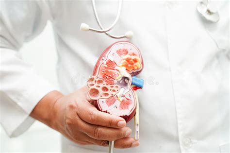 Chronic Kidney Disease Doctor Holding Model For Treatment Urinary