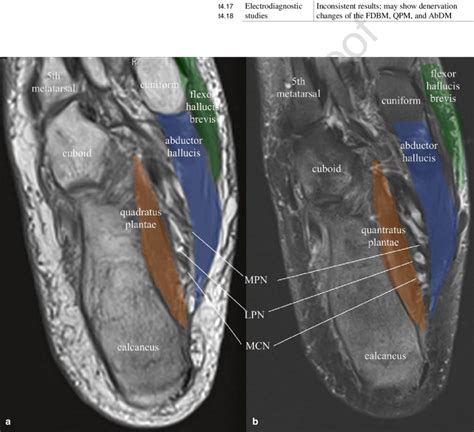 Foot Muscles Mri Anatomy Of The Foot And Ankle Mri