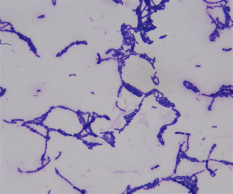 Bacillus Cereus Gram Stain Gram Stain Of A Pure Culture Of Flickr