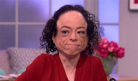 Emilia Fox ‘in Awe Of Silent Witness Liz Carr After Horrific Stabbing