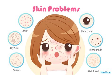 Many types of work involve exposure to heat and where there is too much heat and sweating, followed by too little evaporation of the sweat from the skin, prickly heat. Types of Skin Problems on Face - Medikoe