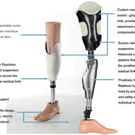 Below Knee Prosthetic Socket Designs And Suspension Systems