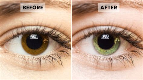 Can You Change Your Eye Color Permanently Eyecandys®