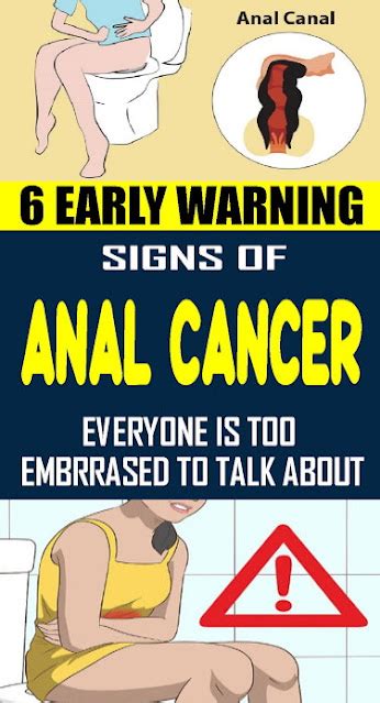 6 Unusual Signs Of Anal Cancer You Shouldnt Ignore Healthy Lifestyle