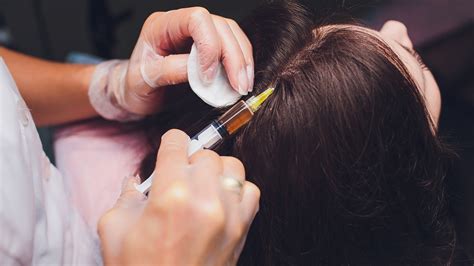 Platelet Rich Plasma - PRP Hair Restoration - #1 Rejuvenation Center in